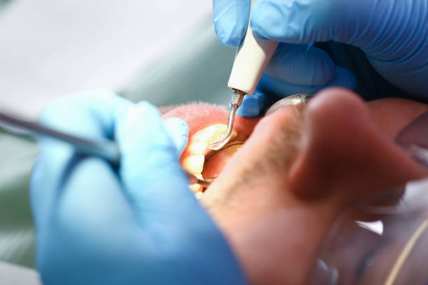 Best Emergency Treatment for Toothache in Appleton City, MO