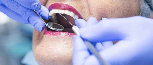 Best Emergency Broken Tooth Repair in Appleton City, MO